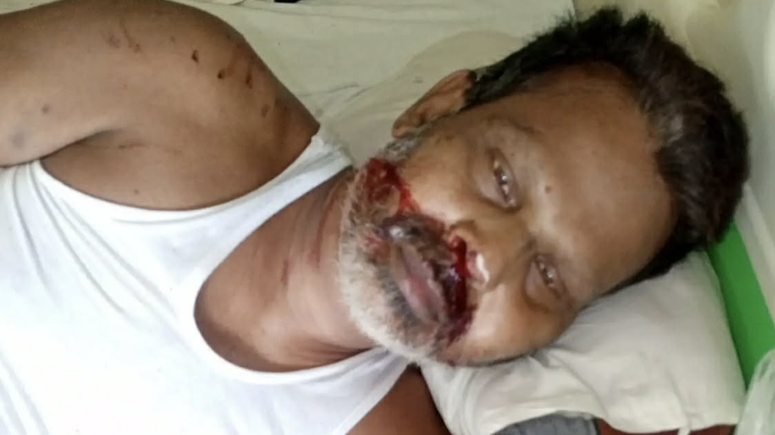 ভালুকায় গ্রাম পুলিশের ক্ষমতা খাটিয়ে মারধর  থানায়  অভিযোগ